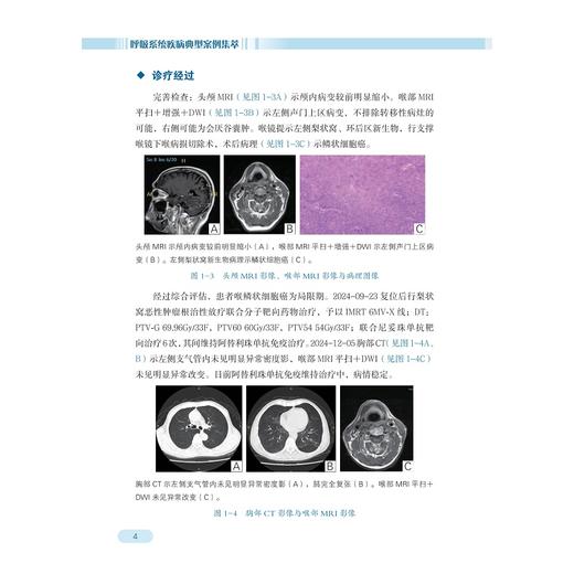 呼吸系统疾病典型案例集萃/王真 主审/吕昕/陈瑞琳 主编/浙江大学出版社 商品图3