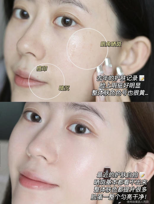 OLAY淡斑小白瓶第三代淡斑美白精华烟酰胺面部方程式精华补水保湿60ml/第四代抗糖50ml 商品图5