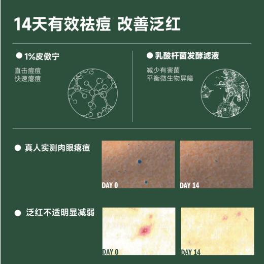 芙芙清透焕肤身体祛痘喷雾150ml 商品图2