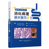 【出版社直发】 临床医生需要知道的消化病理读片技巧修订版 80个典型病例 病理像+内镜CT-MRD 许森林 张华蓉 辽宁科学技术出版社 商品缩略图1
