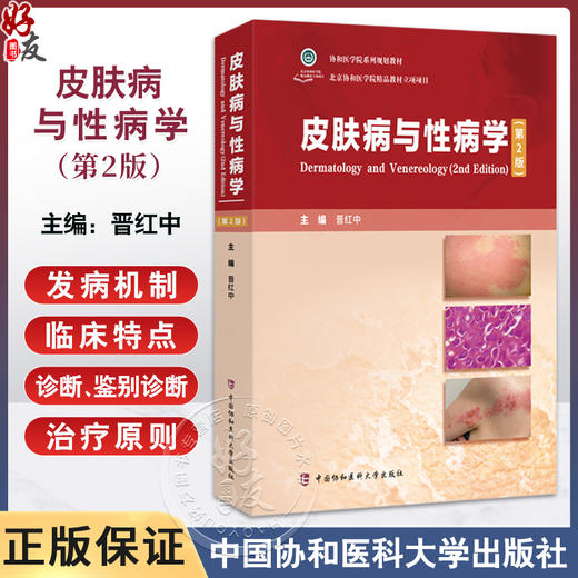 皮肤病与性病学 第2二版 晋红中 主编 本教材介绍常见皮肤病与性病的病因 发病机制 临床特点 鉴别诊断等 中国协和医科大学出版社 商品图0