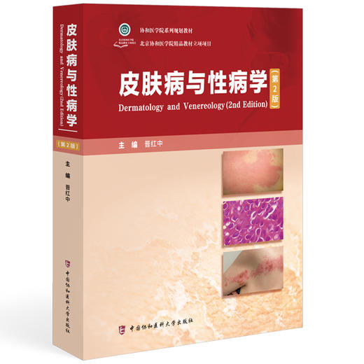 皮肤病与性病学 第2二版 晋红中 主编 本教材介绍常见皮肤病与性病的病因 发病机制 临床特点 鉴别诊断等 中国协和医科大学出版社 商品图1