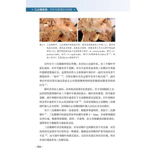 三尖瓣疾病: 评估与管理综合指南/胡盛寿院士王春生教授作序推荐/[美]汉西·马特利尔/[美]斯科特·M. 利利/[美]萨提亚·斯里尼瓦斯 原著主编/马量/李伟栋 主译/浙江大学出版社 商品图4