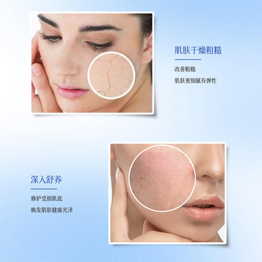 兰贵妃一代美眸紧致精油30ml 商品图3