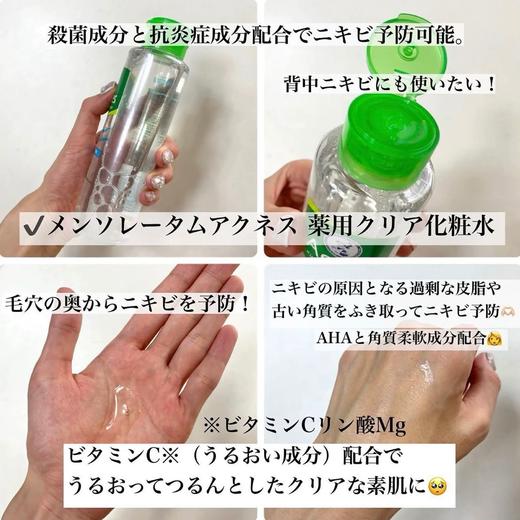 日本曼秀雷敦Acnes乐肤洁痘肌化妆水180ml 商品图4