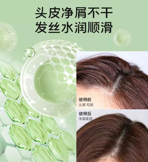 无忧然水润去屑洗发乳450ml-3862 水润去屑 去屑不干燥 商品图3