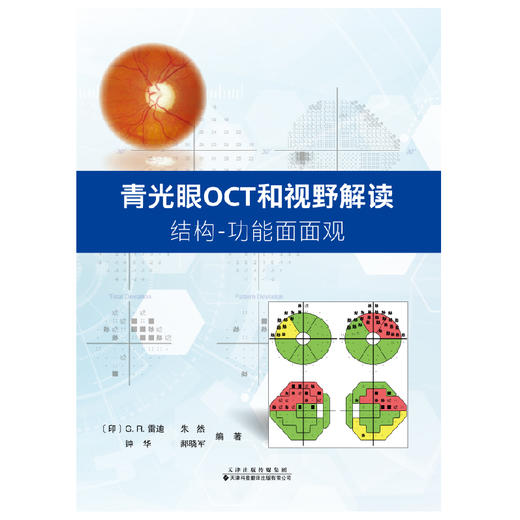 青光眼OCT和视野解读：结构功能面面观 商品图2