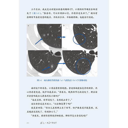 别急！只是个肺结节——乔医生的看病手记 乔贵宾 主编 本书以23个真实诊疗故事为脉络 揭开肺结节的真相 科普 人民卫生出版社 商品图4