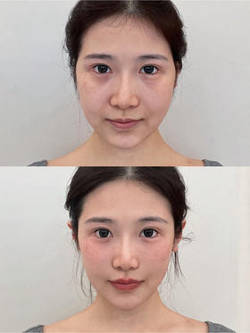 真的仅仅只是微调？太物超所值了！