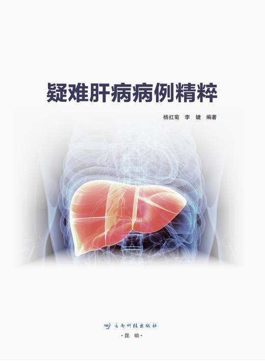 疑难肝病病例精粹（主编：杨红菊 李 婕 ） 商品图2