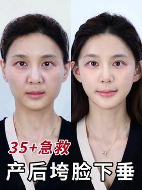 产后全脸紧致提升，看我年轻了多少岁❓
