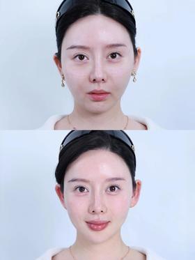 这才是轮廓不流畅的微调教科书~太权威了❗