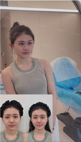 我宣布—微调才是变美的捷径‼