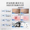 【119元会员福利】敷尔佳清痘净肤次抛精华1.3ml*30支    商品缩略图2