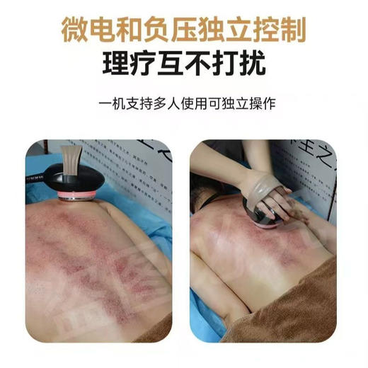 预售：招财妙手大师 身体仪器 商品图3