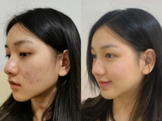 【9.2王炸割肉价】科颜氏高效能小绿瓶5%烟酰胺小绿瓶精华30ml控油提亮舒缓（限26年1月） 商品图3