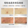 【143元会员福利】敷尔佳乳糖酸控油敛肤面膜25g*5片   商品缩略图2