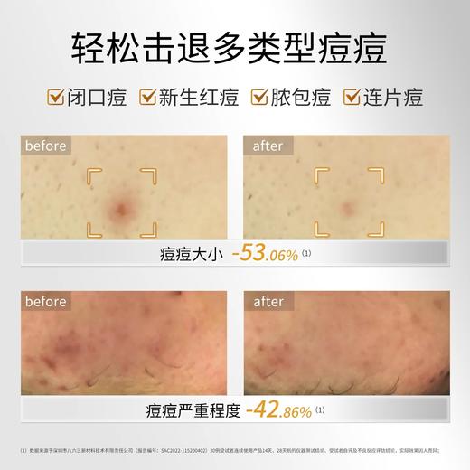 【143元会员福利】敷尔佳乳糖酸控油敛肤面膜25g*5片   商品图2