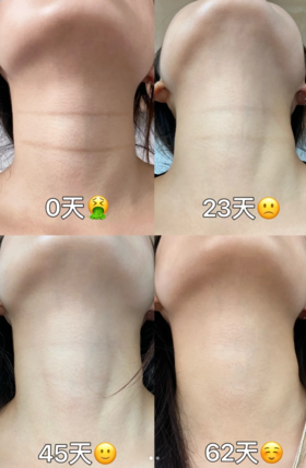 抗皱淡纹玻色因多肽紧致保湿颈膜