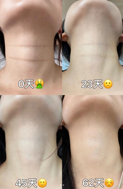 抗皱淡纹玻色因多肽紧致保湿颈膜 商品图0