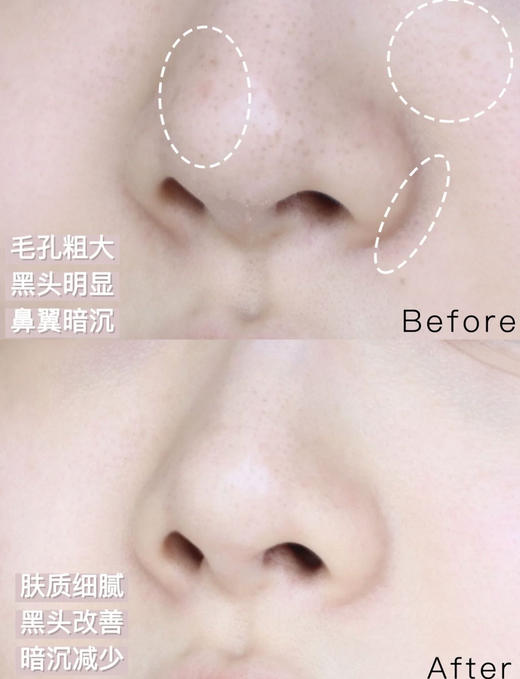 【9.7王炸割肉价】兰蔻极光面霜15ml*3（效期至26.7-27年随机发） 商品图5