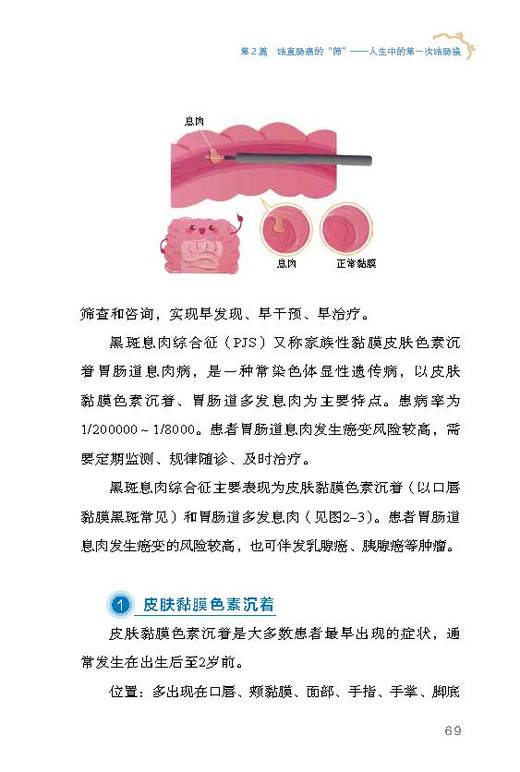 全面说肠癌 科普中国·肿瘤防控科普丛书 商品图3