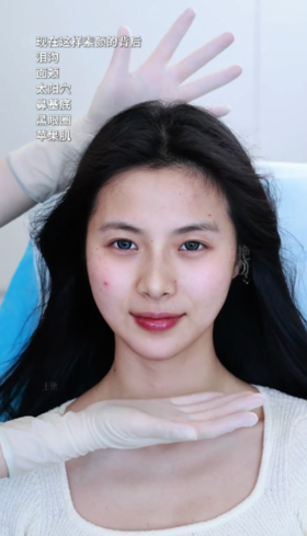 苦相高颧骨微调 被小美狠狠迷住了🤩