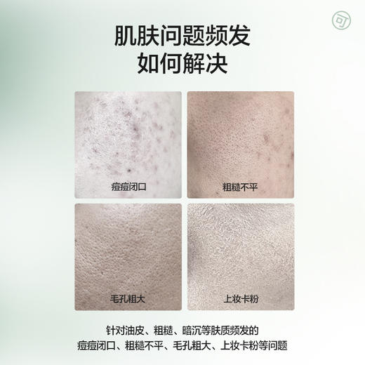 【社群专属】凡可杏仁酸磨皮水焕亮不伤肤 祛痘去角质抛光水修护提亮爽肤水 商品图1