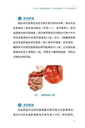 全面说肠癌 科普中国·肿瘤防控科普丛书