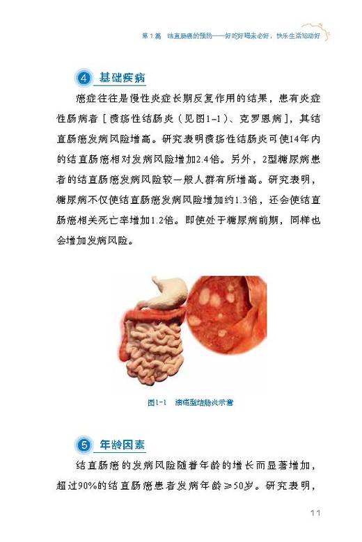 全面说肠癌 科普中国·肿瘤防控科普丛书 商品图0