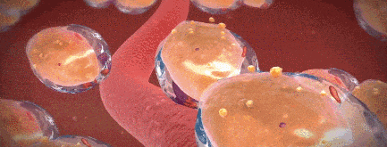 中医鬼才倪海厦：30岁后远离“癌”，每周3次这样做，横扫一身囊肿、结节和包块