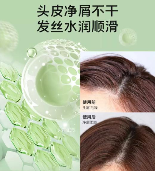 无忧然水润去屑洗发乳300ml-3855 商品图3
