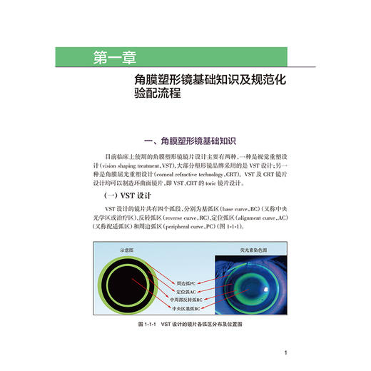 角膜塑形镜验配实用案例解析 魏瑞华 杜蓓 本书以临床案例为依托分为验配案例复诊调片案例随访依从性差案例三大部分人民卫生出版社 商品图4