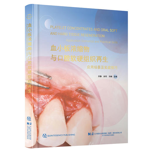 【出版社直发】血小板浓缩物与口腔软硬组织再生 乔静 孙凤 刘峰 深度聚焦血小板浓缩物（PRP、PRF、CGF等）辽宁科学技术出版社 商品图1