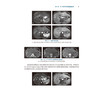 肝脏肿瘤消融治疗案例精析 肿瘤消融治疗技术规范化培训配套教材 范卫君 主编 参考书 西医 肿瘤学 9787117380683 人民卫生出版社 商品缩略图4