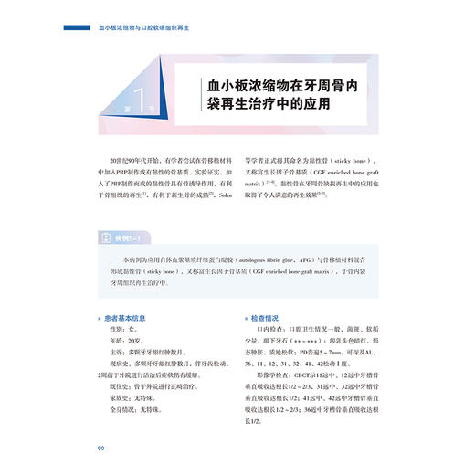 【出版社直发】血小板浓缩物与口腔软硬组织再生 乔静 孙凤 刘峰 深度聚焦血小板浓缩物（PRP、PRF、CGF等）辽宁科学技术出版社 商品图3