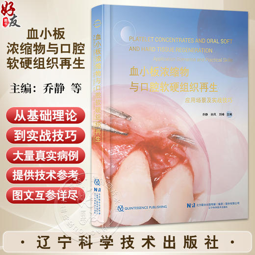 【出版社直发】血小板浓缩物与口腔软硬组织再生 乔静 孙凤 刘峰 深度聚焦血小板浓缩物（PRP、PRF、CGF等）辽宁科学技术出版社 商品图0