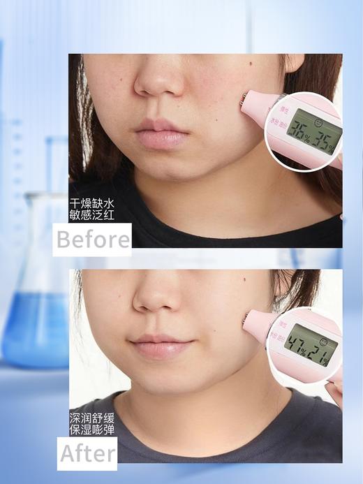 【防晒修护日 必囤面膜】美在伽医用冷敷型 商品图3