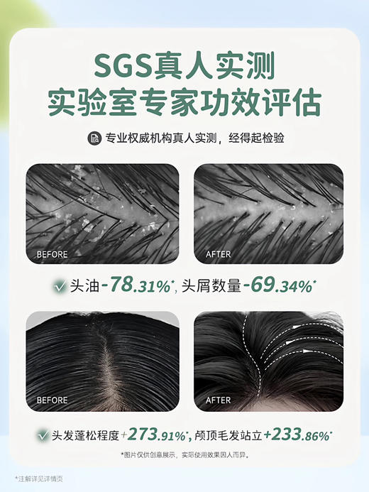 袋鼠妈妈青少年去屑 柔顺 控油洗发水 商品图1