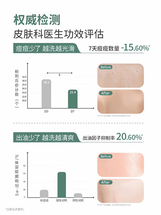 袋鼠妈妈祛痘净澈沐浴露 商品图1