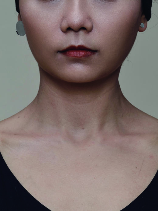 SSCE｜222SAQ3E203F Earrings坐标不对称耳环20x20mm 6x6mm【QUANTUM TAG】 商品图1