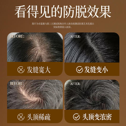 【3瓶装】卓蓝雅防脱固发头皮精华液50ml （10号）ZT-1 商品图5