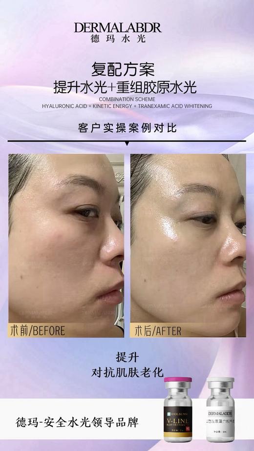 德玛-械字号水光精华液 商品图5