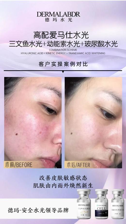 德玛-械字号水光精华液 商品图7