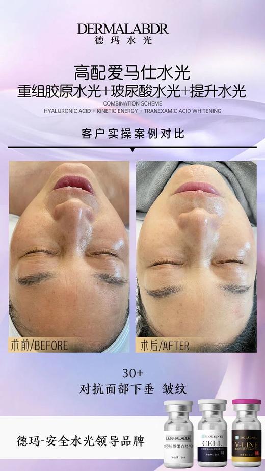 德玛-械字号水光精华液 商品图9