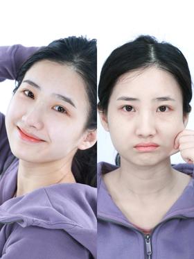 老天奶！广州热玛吉你这么会提升不要命了？