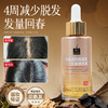 【3瓶装】卓蓝雅防脱固发头皮精华液50ml （10号）ZT-1 商品缩略图1