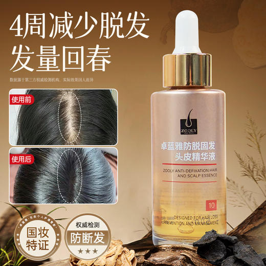 【3瓶装】卓蓝雅防脱固发头皮精华液50ml （10号）ZT-1 商品图1