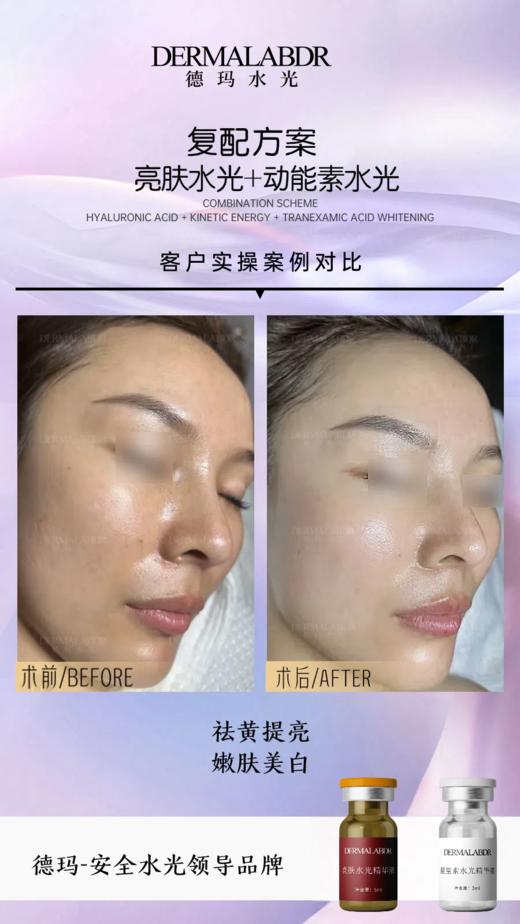 德玛-械字号水光精华液 商品图8