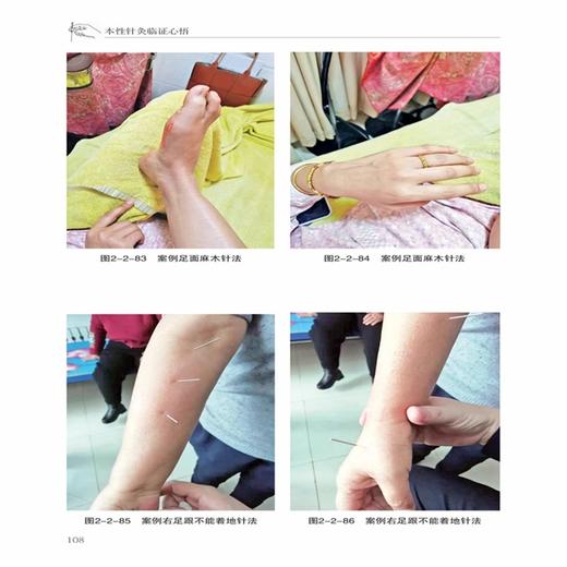 本性针灸临证心悟 于本性 主编 经络平衡针法 解决经络病人迎寸口脉针法 解决多种内科疾病 9787559141446 辽宁科学技术出版社 商品图2
